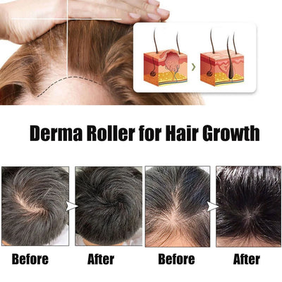 Beauty Derma Roller